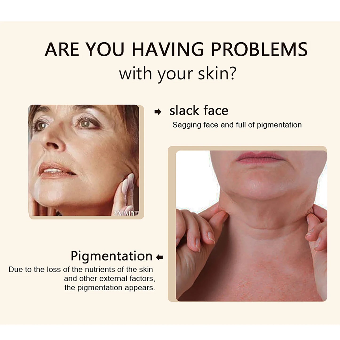 KYLIEFIT Collagen Whitening Cream For Radiant Skin And Hydration